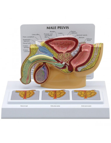 Modello anatomico di Pelvi maschile con prostata 3D in sezione 3B Scientific 1019563