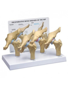 Modello di patologie...