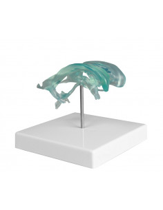 Ventricolo cerebrale su...