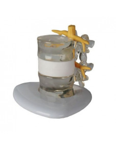 Erler Zimmer, simulatore di...