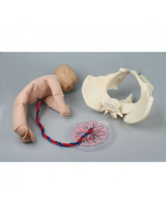 Erler Zimmer, Pelvi...