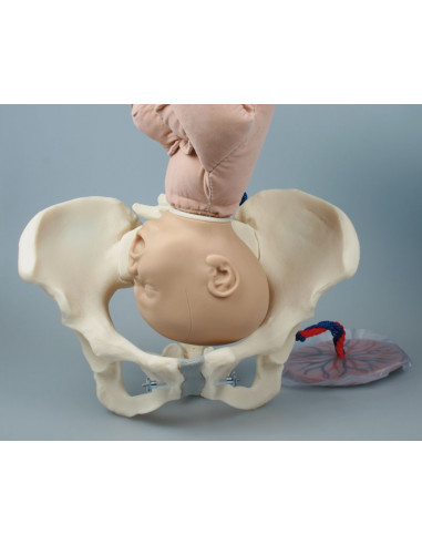 Erler Zimmer, Pelvi femminile con...