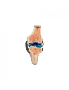 Sezione dell'articolazione...