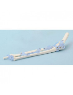 Erler Zimmer, modello...