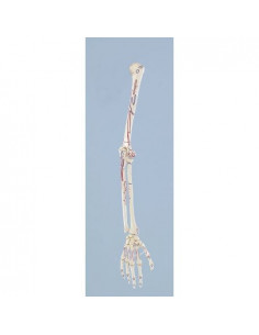 Erler Zimmer, modello...