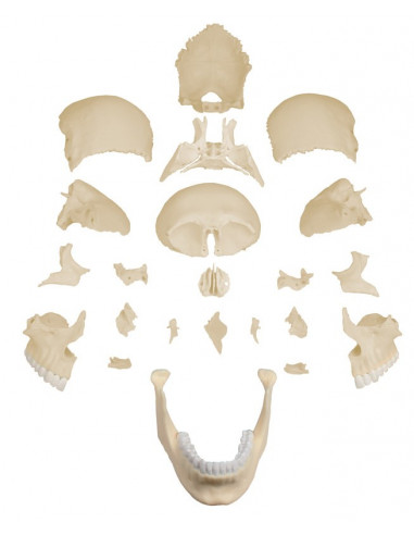 Erler Zimmer, modello di cranio...