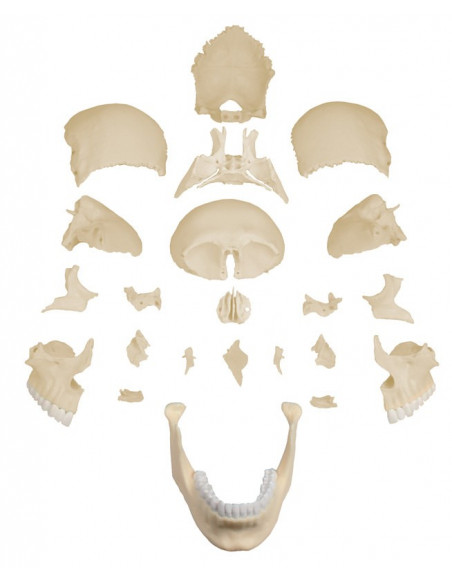 Erler Zimmer, modello di cranio bianco scomponibile in 22 parti 4701