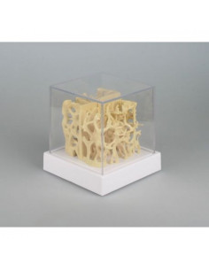 Erler Zimmer, confronto fra...