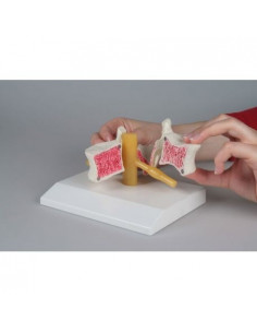 Erler Zimmer, modello...