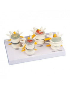 Erler Zimmer, modello...