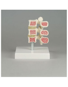 Erler ZImmer, modello...