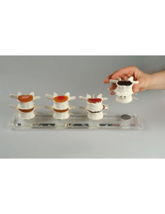 Erler Zimmer, modello... 2