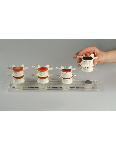 Erler Zimmer, modello anatomico di...