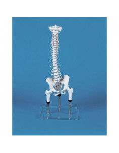 Erler Zimmer, Colonna...