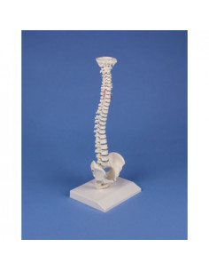 Erler Zimmer, colonna...