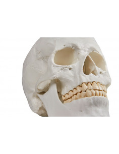 Erler Zimmer, Cranio,... 2