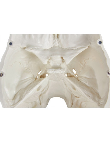 Erler Zimmer, Cranio, modello...