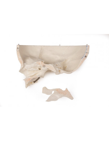 Cranio bambino di lusso per studi avanzati, in 14 parti Erler Zimmer 4810