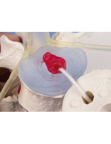 Erler Zimmer modello anatomico...